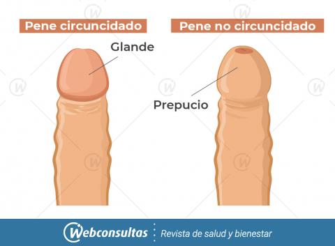 Circuncisión en adultos