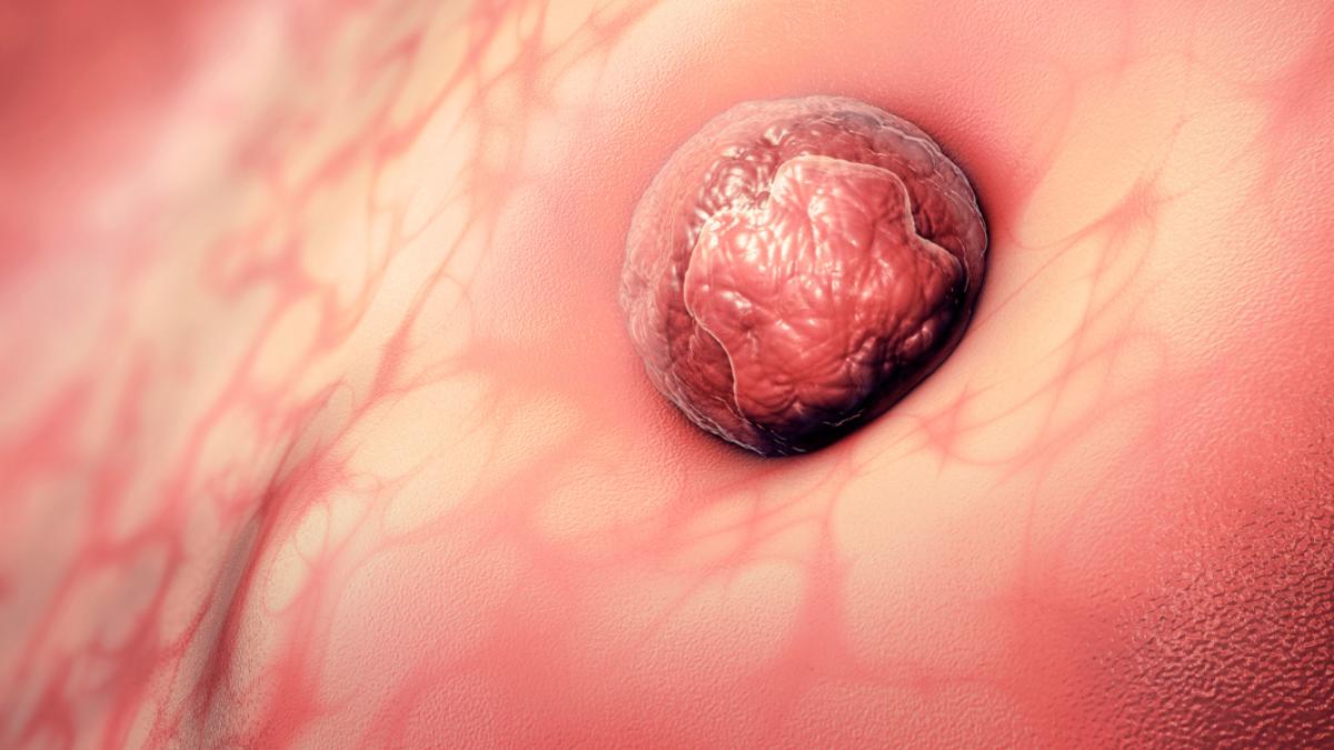 Implantación embrionaria y fallo de implantación, qué son
