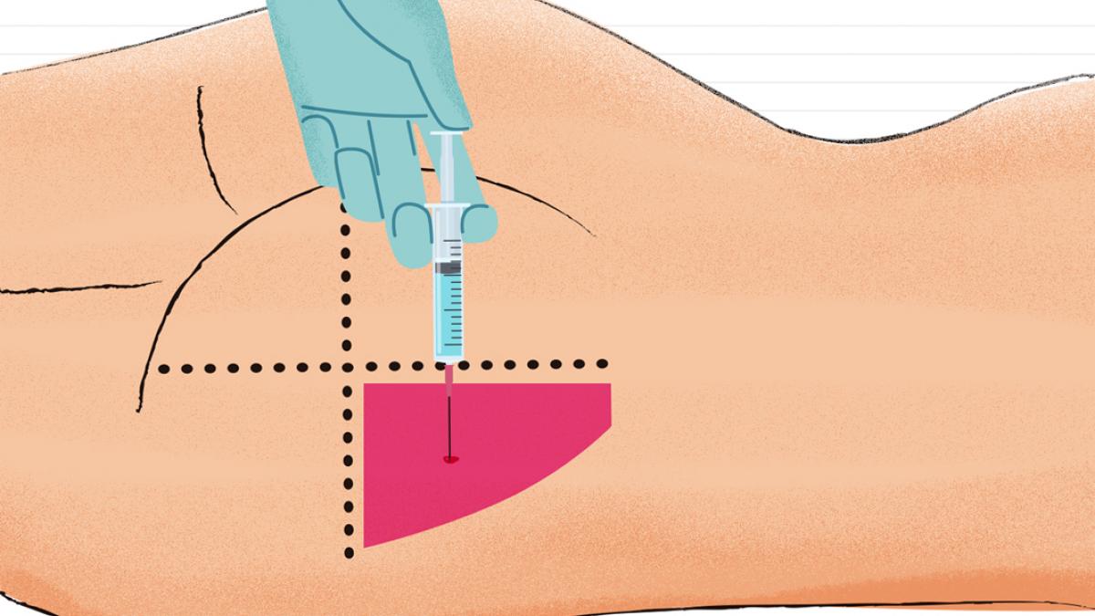 Cómo poner una inyección intramuscular (y dónde) paso a paso
