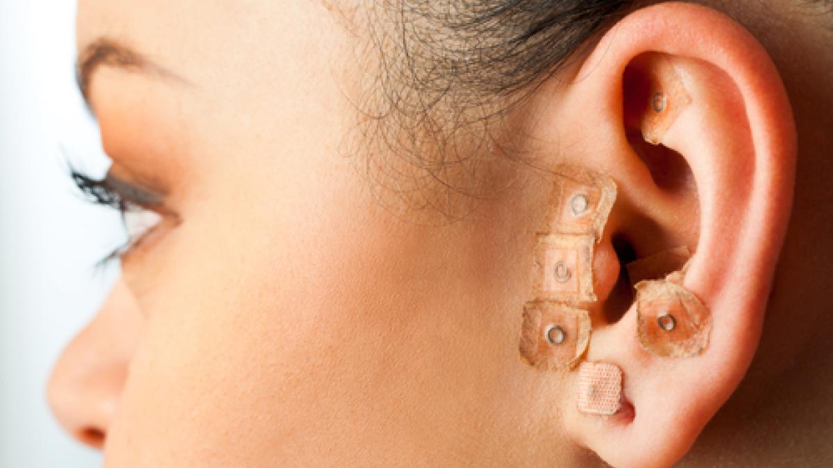 Auriculoterapia o la moda de las pegatinas doradas en las orejas 